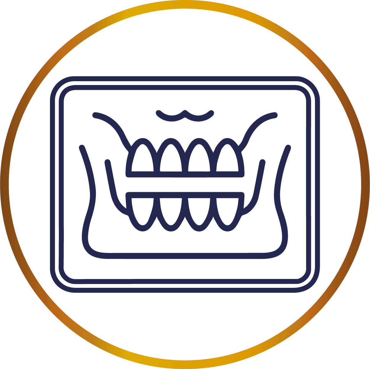 Diseño de Sonrisa